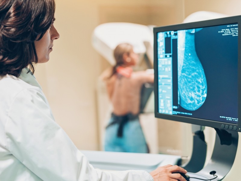 Revista Ceará apoiará entidade filantrópica que previne e diagnostica o câncer de mama
